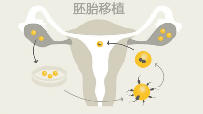 试管婴儿移植之后可不可以洗澡插图 试管婴儿移植之后可不可以洗澡插图