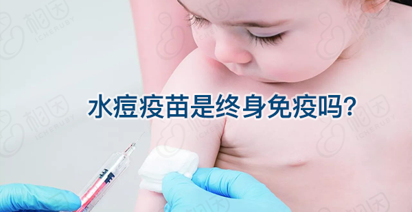 宝宝接种水痘疫苗能维持多久时间？一到两次或可终身免疫插图