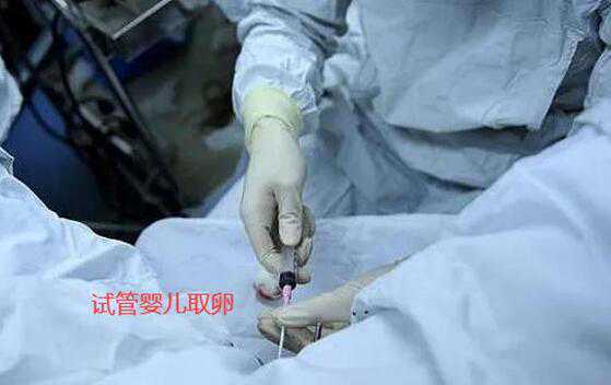 私立医院供卵大概要多少钱?附详细费用情况插图 1657331360545165.jpeg