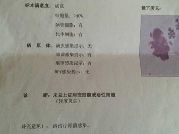 教你tct检查结果怎么看插图