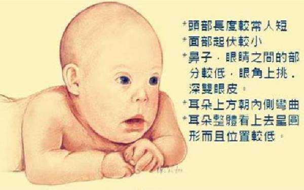 做试管婴儿如何预防唐氏综合征?有哪些高危人群?插图 做试管婴儿如何预防唐氏综合征?有哪些高危人群?插图