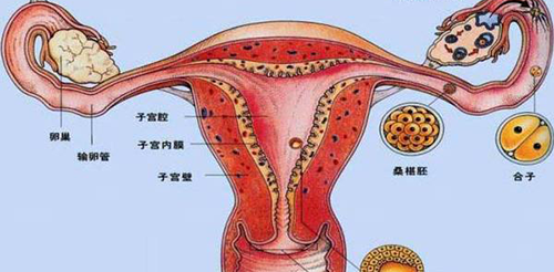 子宫畸形有哪些危害？可以怀孕吗？插图