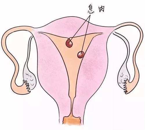 广东揭阳爱维艾夫医院做试管多少钱?广东育儿假10天必须连着休吗?插图 广东揭阳爱维艾夫医院做试管多少钱?广东育儿假10天必须连着休吗?插图