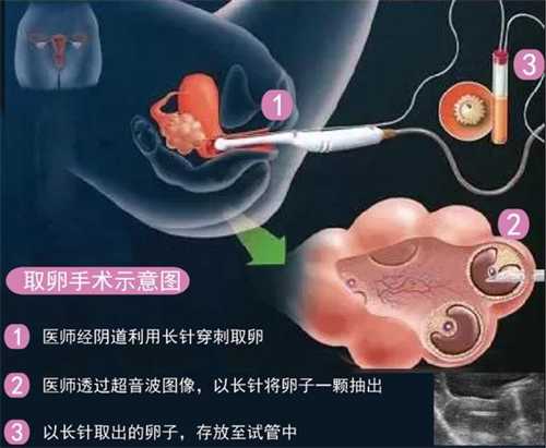 上海长海医院可以做供卵试管包生男孩吗?可以接受供卵的人群有哪些?插图 上海长海医院可以做供卵试管包生男孩吗?可以接受供卵的人群有哪些?插图