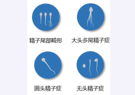 畸精症（teratozoospermia）插图