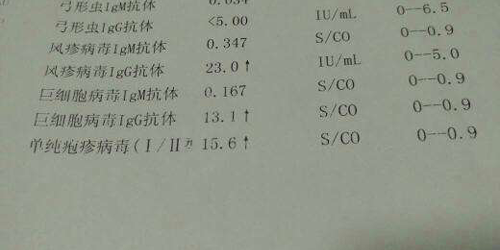 单纯疱疹病毒抗体怀孕有保障,预防死胎|畸形等不幸出现插图 单纯疱疹病毒抗体怀孕有保障,预防死胎|畸形等不幸出现插图
