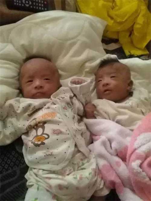 试管婴儿取卵前有哪些注意事项 泰国试管取卵与国内有什么不同插图2