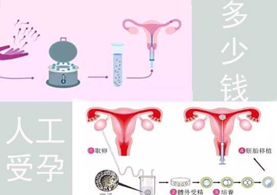人工受孕多少钱?插图 人工受孕多少钱?插图