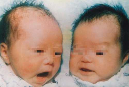 深圳妇幼保健院哪位试管医生技术好 做试管双胞胎大概需要多少钱插图 深圳妇幼保健院哪位试管医生技术好 做试管双胞胎大概需要多少钱插图
