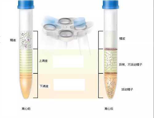 江苏省妇幼和南京市妇幼哪个做试管婴儿比较好?江苏哪家试管婴儿医院更好?插图 江苏省妇幼和南京市妇幼哪个做试管婴儿比较好?江苏哪家试管婴儿医院更好?插图