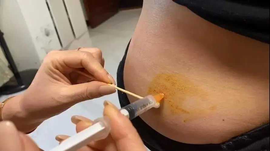 临沂和济南可做试管的医院有哪些？山东济南做试管医院哪家好？插图