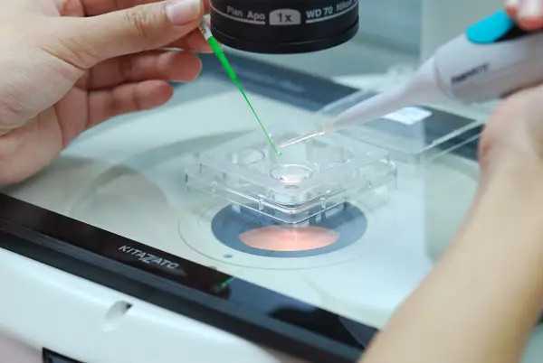 马来西亚试管婴儿怎么样?马来试管医院做试管有哪些流程?插图2 马来西亚试管婴儿怎么样?马来试管医院做试管有哪些流程?插图2