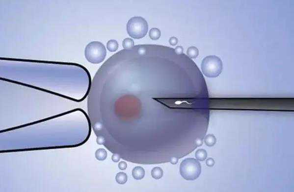 深圳妇幼保健院做三代试管婴儿费用要多少钱?成功率高吗?插图 深圳妇幼保健院做三代试管婴儿费用要多少钱?成功率高吗?插图