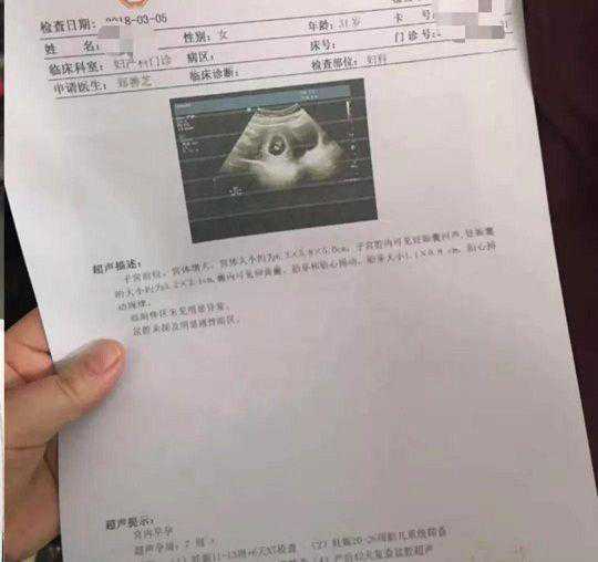 多囊6年不孕的我，历经2促4移，如何在34岁收获好孕？插图6