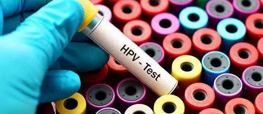 孕检常规检查项目里有hpv这一项吗?插图 孕检常规检查项目里有hpv这一项吗?插图