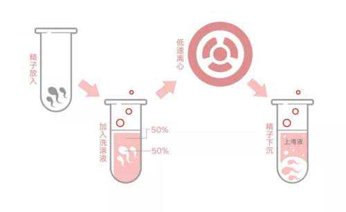 泰国能给否给hiv患者洗精，要注意哪些事情插图
