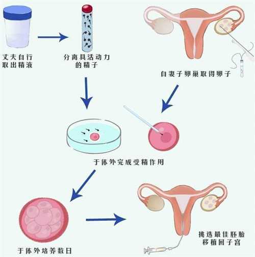 什么是供卵试管婴儿？河北做供卵试管可以生男生女吗？插图