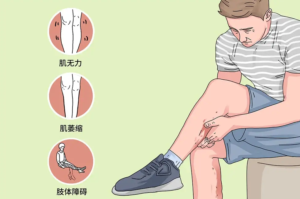 患有腓骨肌萎缩症可以做试管婴儿吗？插图