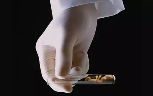 供卵怀上宝宝后的注意事项有哪些？做供卵试管产检时需要做羊水穿刺检查吗？插图