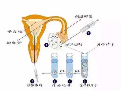 济南供卵试管生男孩包成功费用多少?济南军区总医院试管步骤是什么?插图 济南供卵试管生男孩包成功费用多少?济南军区总医院试管步骤是什么?插图