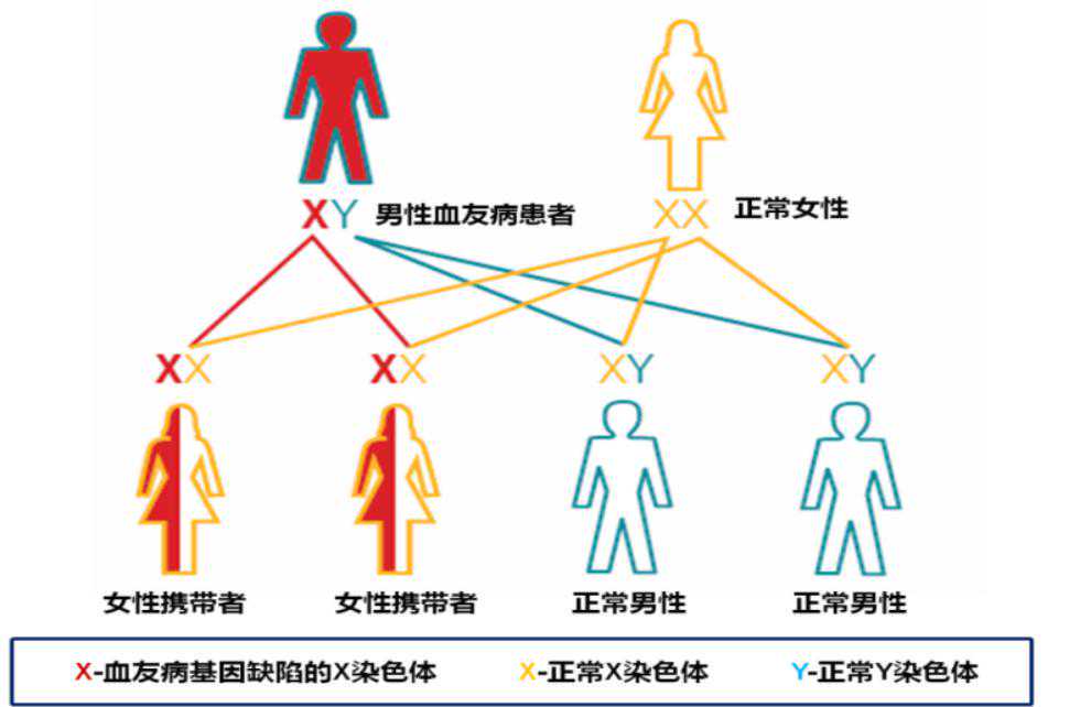 血友病携带者可以做试管婴儿吗?要多少钱?插图 血友病携带者可以做试管婴儿吗?要多少钱?插图