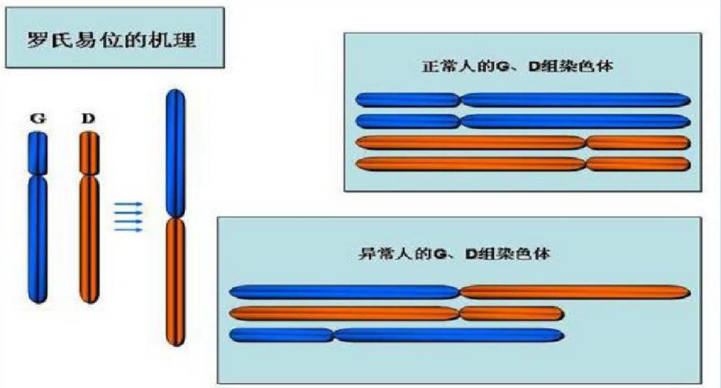 罗氏易位做三代试管成功率有多少？插图