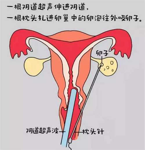 漳州试管医院价格大概要多少钱？漳州只有一家医院能做试管？插图