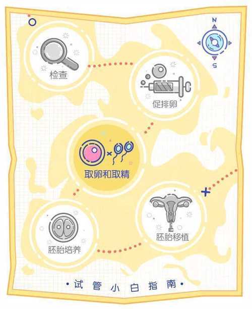 一代试管取卵费用多少？附二代试管取卵费用明细！插图