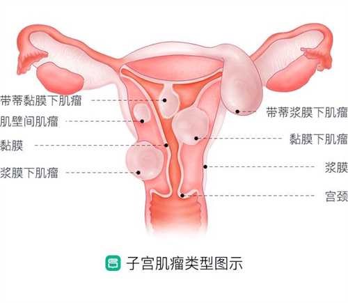 潍坊人民医院试管婴儿多少钱？潍坊生殖医院试管婴儿多少钱？插图