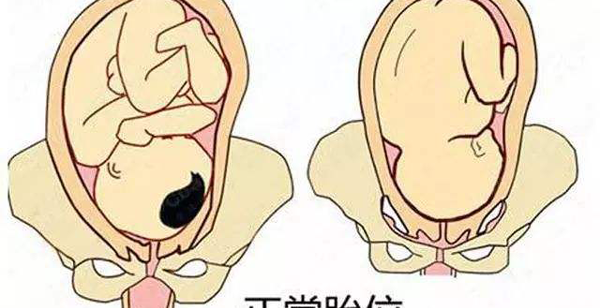 试管婴儿怀孕后要做哪些检查？280天最全产检时间表分享插图5