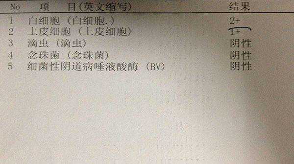 孕初期白带常规检查6大流程,从挂号到出结果均不费时插图3 孕初期白带常规检查6大流程,从挂号到出结果均不费时插图3