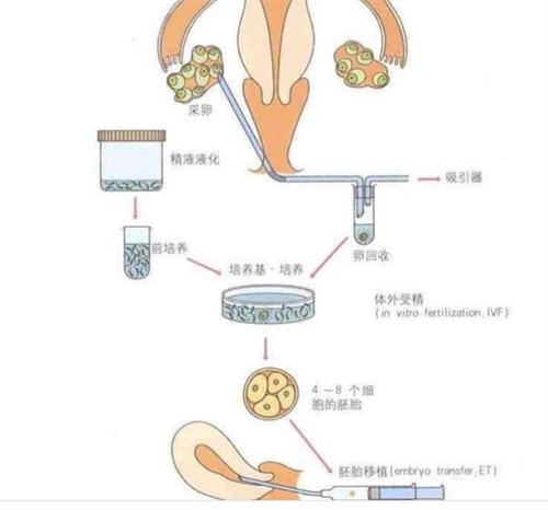 金华做供卵试管排队等待多长时间？供卵试管需要等多久？插图2