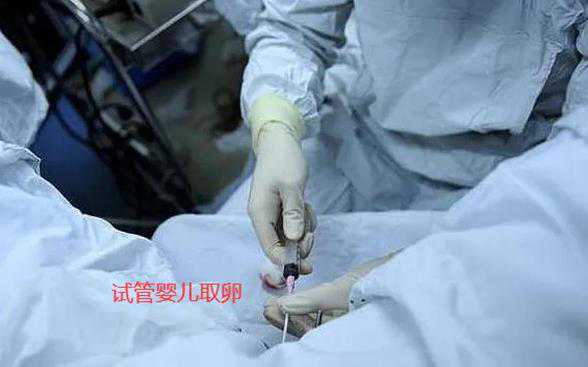 试管婴儿取卵无痛的真相是什么?取卵真的无痛吗?插图 试管婴儿取卵无痛的真相是什么?取卵真的无痛吗?插图