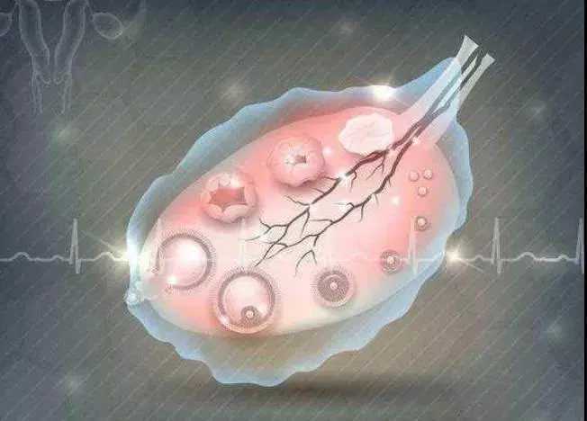 取卵后腹水的高峰期是什么时候？取卵后什么时候腹水最多？插图