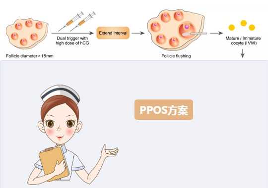 试管婴儿PPOS是什么促排卵方案?插图