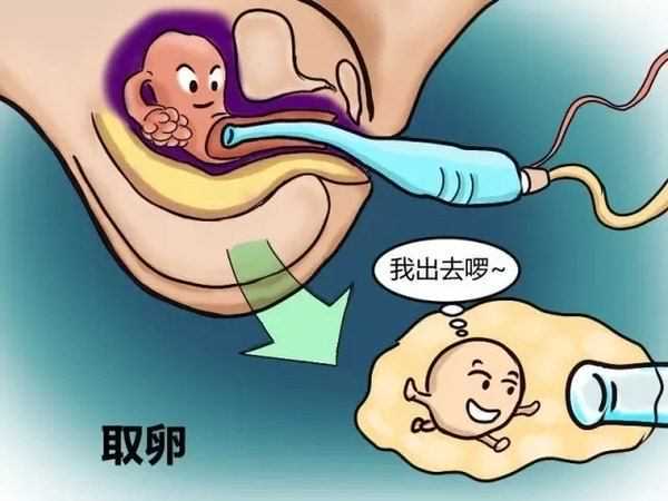 女性做试管婴儿过程很痛苦吗？做试管婴儿详细步骤！插图1