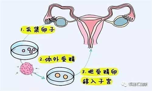 深圳哪家医院能做第三代试管？深圳三代试管婴儿医院介绍插图