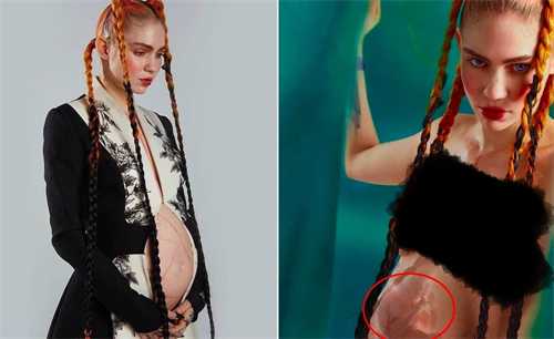 上海集爱遗传医院靠谱吗？做试管婴儿费用贵不贵插图