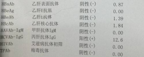 丙肝抗体阳性怎么办,肝功能正常不管可发展到肝癌插图1