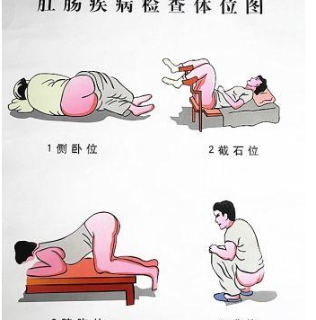 孕妇和产妇都能做，胸膝卧位的这些适用人群可了解下插图