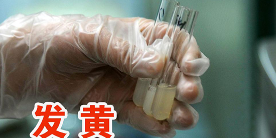 体格|精液|睾丸都需检测!死精症的5大临床检查一览插图3