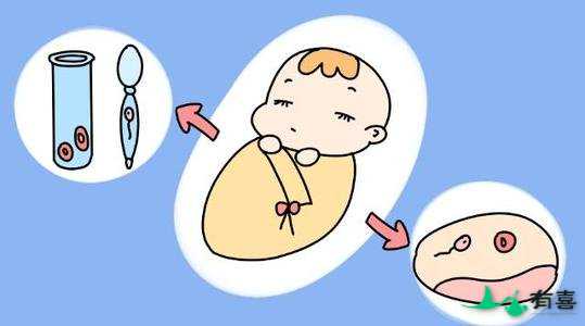 泰国试管婴儿流程步骤有哪些,此文为您解惑插图1 泰国试管婴儿流程步骤有哪些,此文为您解惑插图1