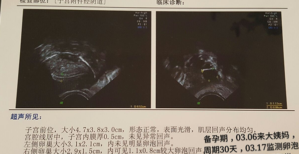 不止要看b超报告单!上海集爱试管全部检查项目汇总插图3 不止要看b超报告单!上海集爱试管全部检查项目汇总插图3