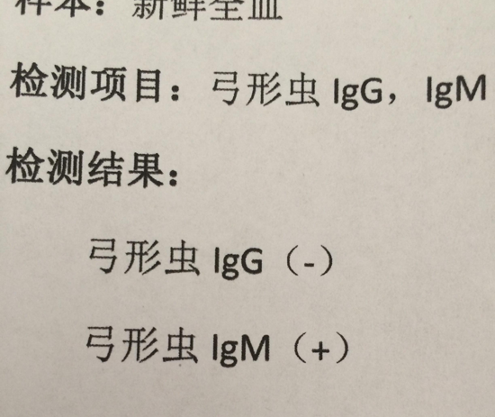 孕期知识科普:关于弓形虫igg和igm的区别在这里插图 孕期知识科普:关于弓形虫igg和igm的区别在这里插图