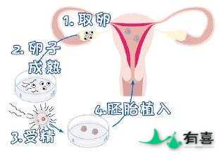 乌克兰试管婴儿费用[超详细]插图1