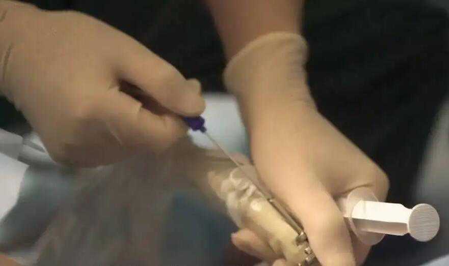 试管婴儿取卵后能不能骑车？取卵后骑车有风险吗？插图1
