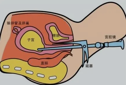 AMH29快要绝经还能自然怀孕吗?试管婴儿可能是你的选择插图 AMH29快要绝经还能自然怀孕吗?试管婴儿可能是你的选择插图