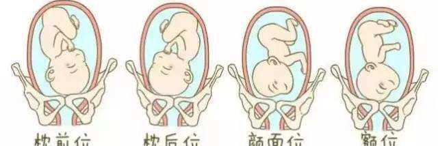 孕妇和产妇都能做，胸膝卧位的这些适用人群可了解下插图1