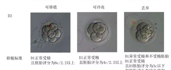 取卵和胚胎培养环节最重要？做试管婴儿的你一定不知道！插图7