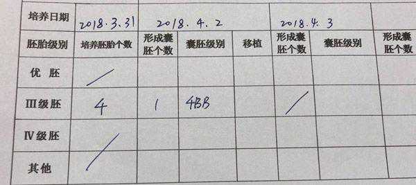 囊胚4bb是男孩机会大吗？生男生女概率都只有50%插图2